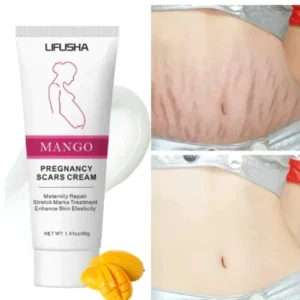 ครีมลบรอยแผลเป็น